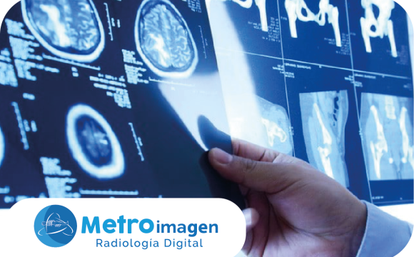 imagenologia_Mesa de trabajo 1 Imagenología